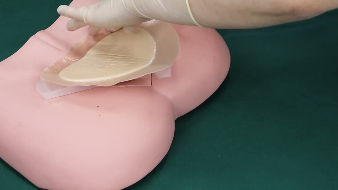 Alexer Silicone Foam Dressing Sacrum-skin color