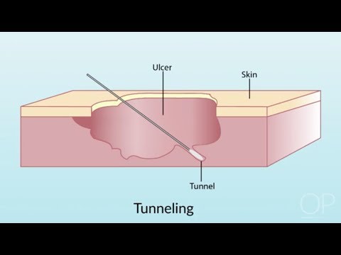 Dressing a Pressure Injury by S. Hamilton | OPENPediatrics