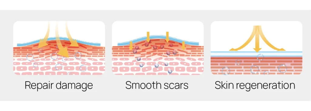 Product description of silicone scar sheets