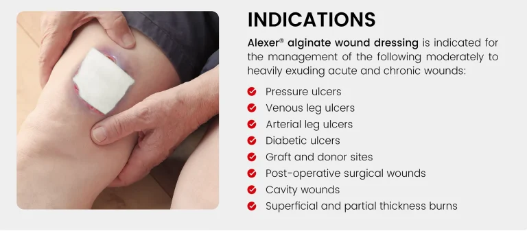 Usage Scenario Examples of Alexer® Alginate Wound Dressing