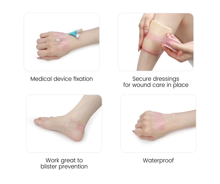 Alexer® medical silicone tape,