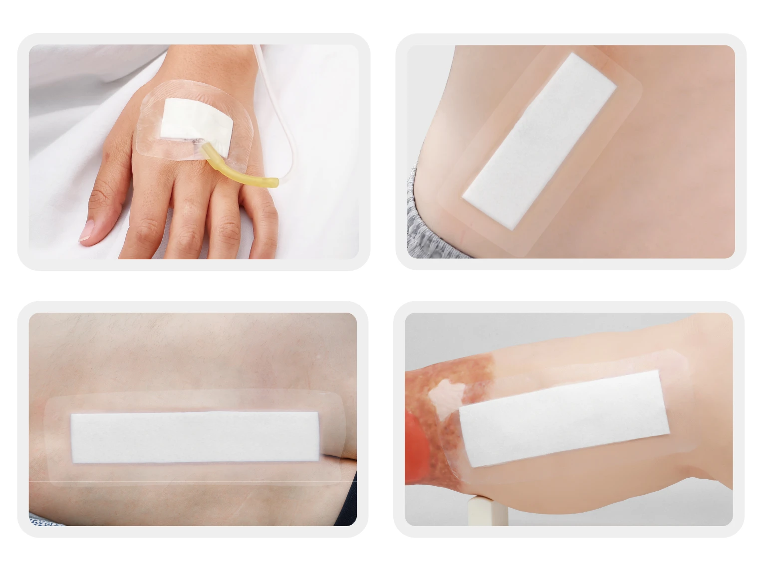 Usage Scenario Examples of Transparent Dressing with Pad