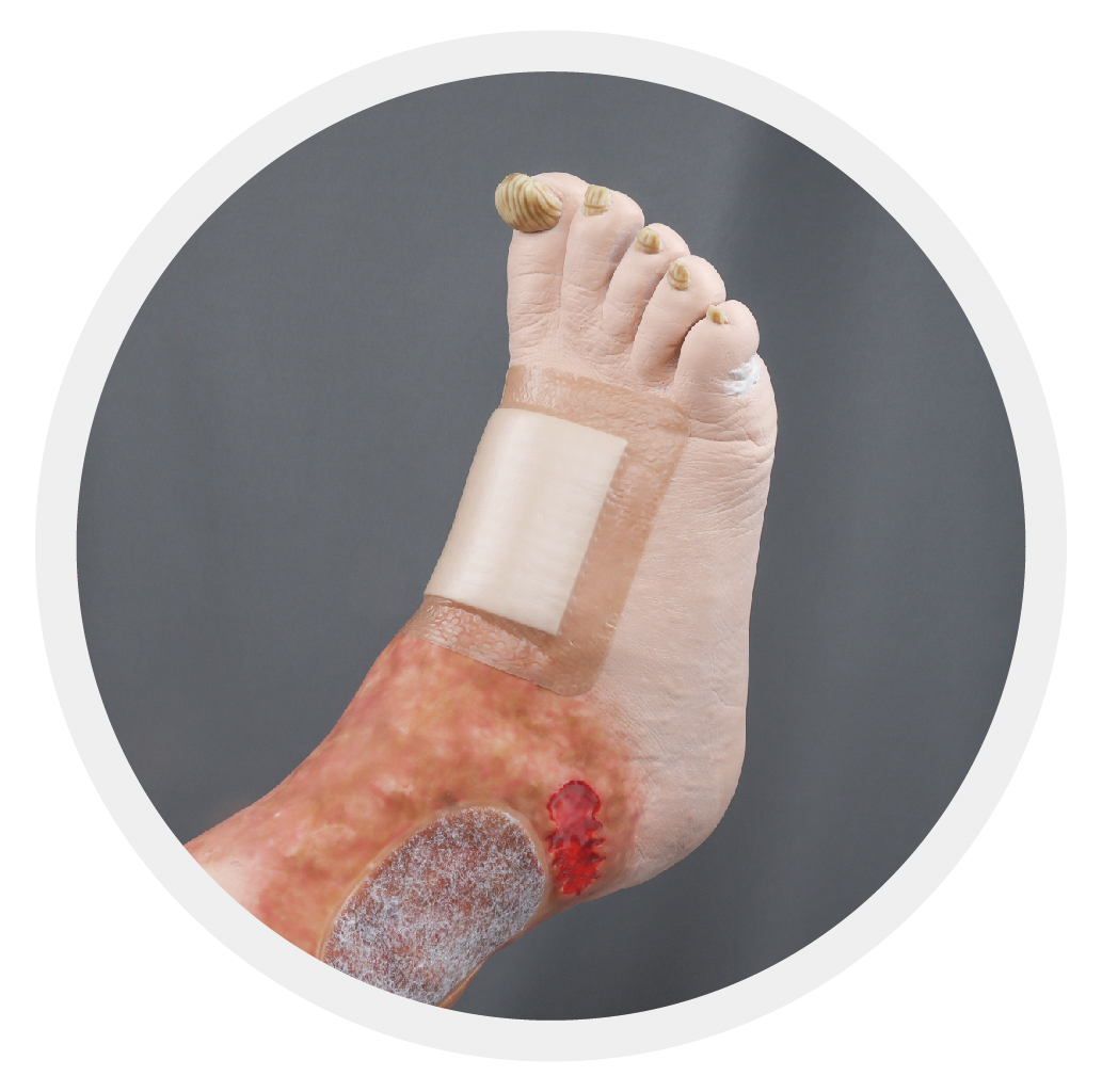Assessing Your Injury and Choosing the Right Wound Dressing Bandage