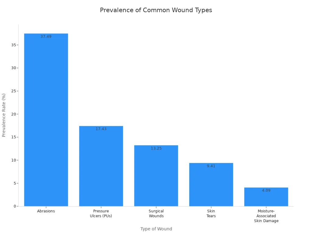Bar chart comparing prevalence rates of common wound types in clinical practice