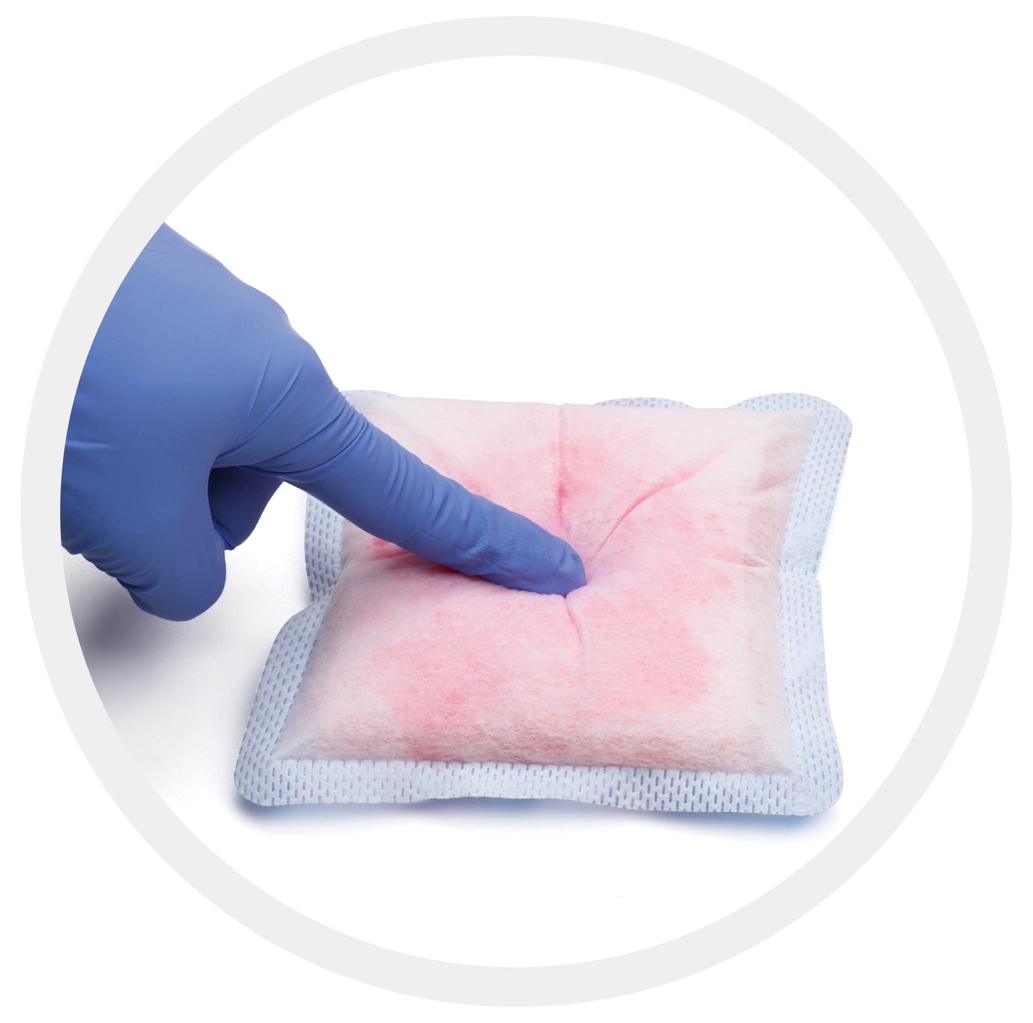 Absorbent Wound Dressing Mechanism
