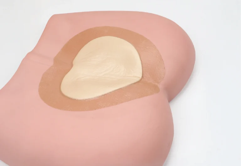 Sacrum silicone foam dressing for pressure injury prevention, SLK Medical wound dressing supply company