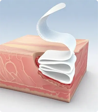 Alginate Wound Dressing