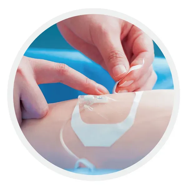 Transparent Dressing