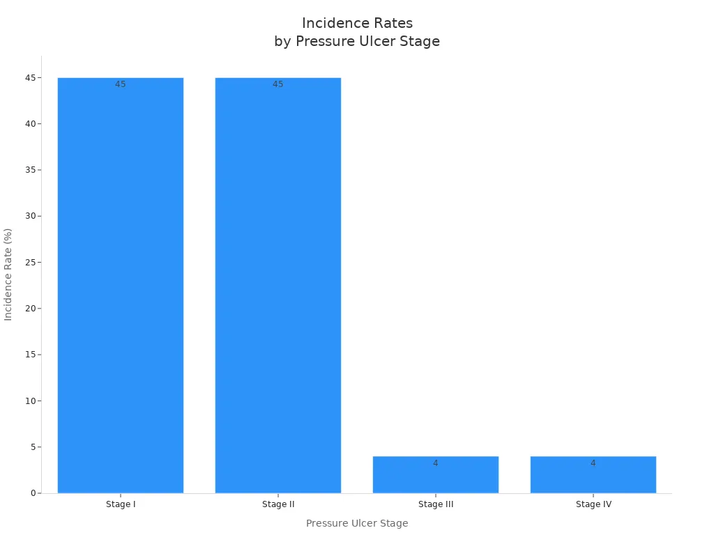 Bar chart comparing incidence rates of pressure ulcers by stage
