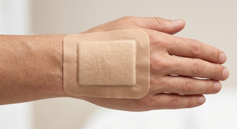 Clinician applying a bordered silicone foam dressing in a clean clinical setting.